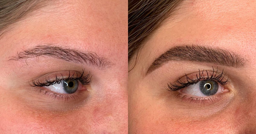 Before and after comparison of eyebrow growth progress